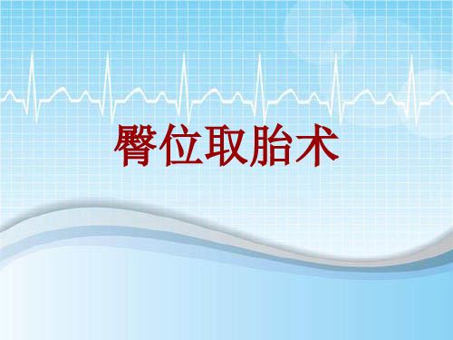 手术讲解模板：臀位取胎术