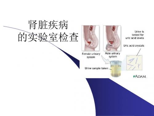 肾脏疾病的实验室检查ppt课件