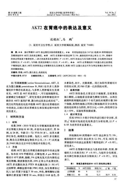 AKT2在胃癌中的表达及意义