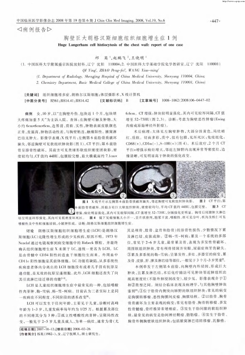 胸壁巨大朗格汉斯细胞组织细胞增生症1例