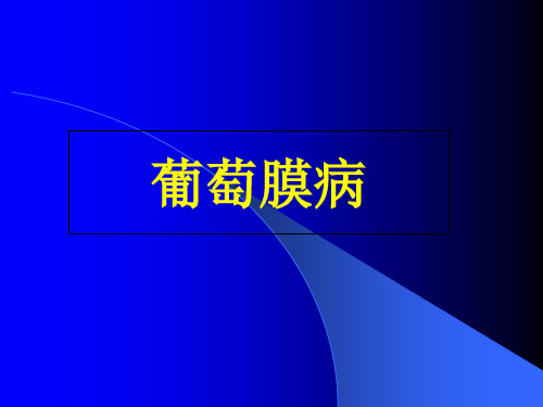 眼科学——葡萄膜病