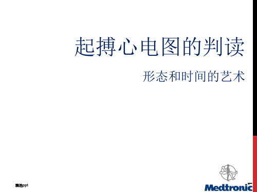 起搏心电图ppt课件