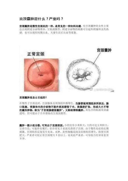 宫颈囊肿是什么