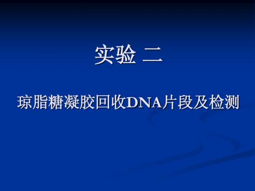 02 琼脂糖凝胶回收DNA片段及检测