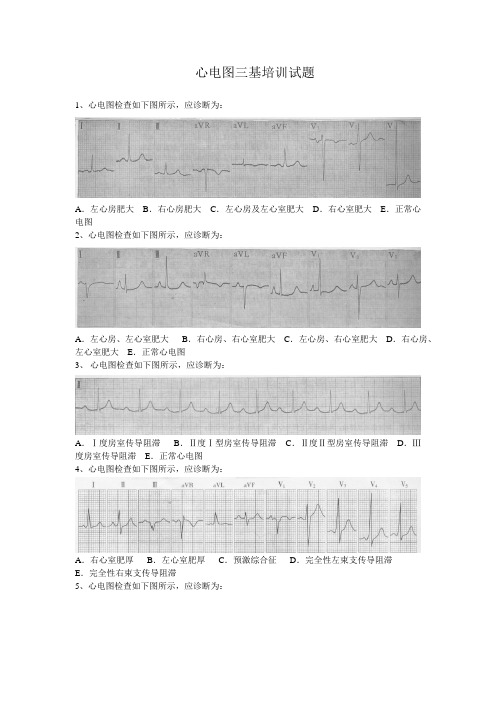 三基培训心电图试题