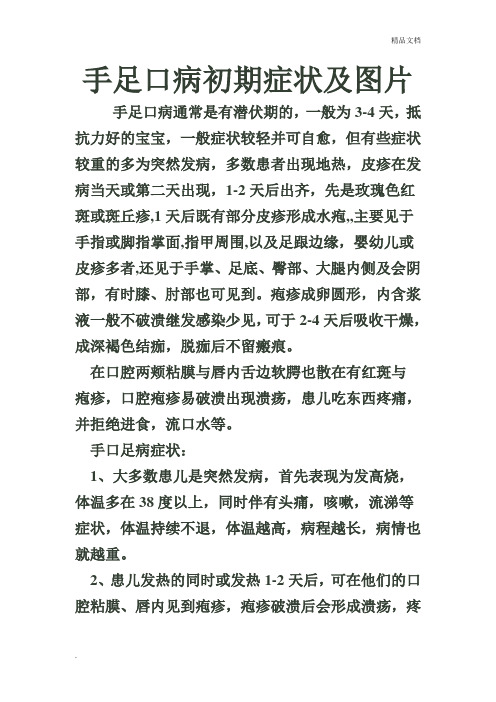 手足口病初期症状及图片