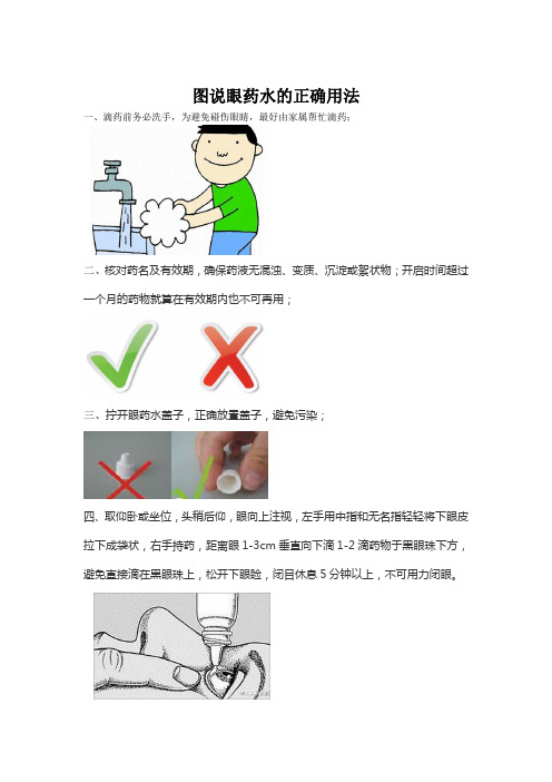 怎样正确滴用眼药水