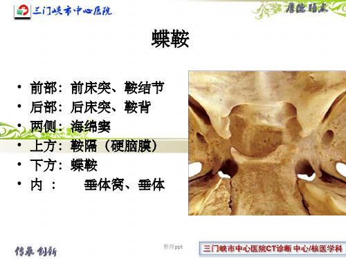 垂体解剖及垂体瘤