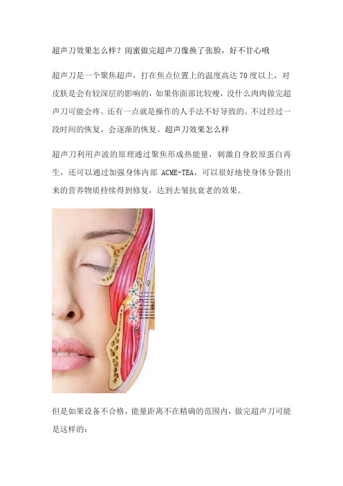 超声刀效果怎么样？闺蜜做完超声刀像换了张脸,好不甘心哦