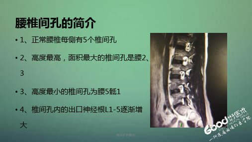 椎间孔的解剖 (新课件)