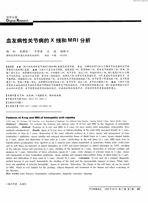 血友病性关节病的X线和MRI分析