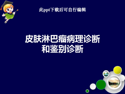 皮肤淋巴瘤病理诊断和鉴别诊断ppt课件