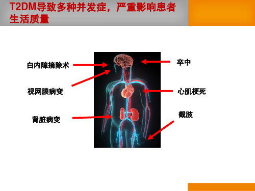 达美康缓释片：中国T2DM患者的优化降糖方案共28页文档