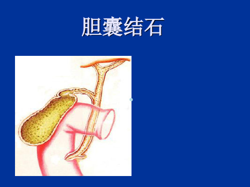 胆囊结石及防治课件