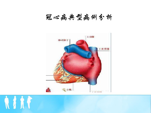 冠心病典型病例