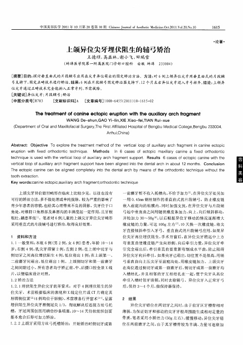 上颌异位尖牙埋伏阻生的辅弓矫治