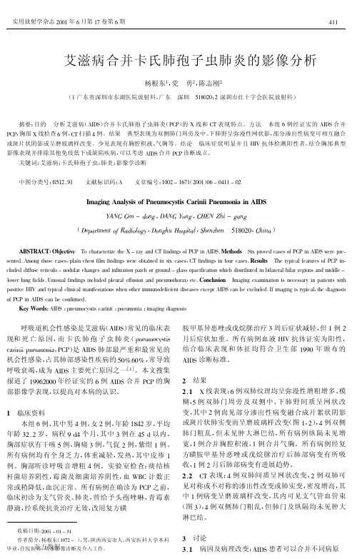 艾滋病合并卡氏肺孢子虫肺炎的影像分析