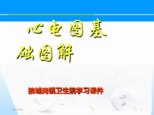 心电图基础图解