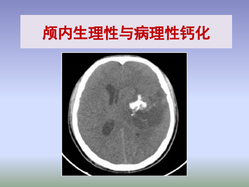 颅内生理性钙化与病理性钙化