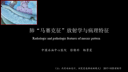 马赛克征放射学与病理