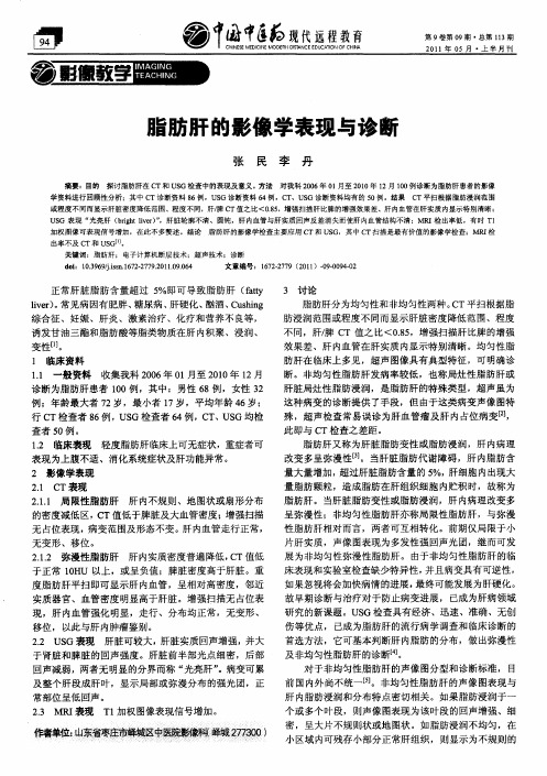 脂肪肝的影像学表现与诊断