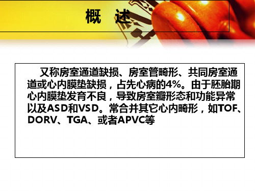 房室间隔缺损(1)_PPT课件