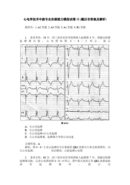 心电学技术中级专业实践能力模拟试卷11(题后含答案及解析)