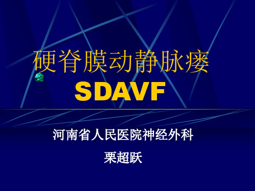 硬脊膜动静脉瘘 栗超跃