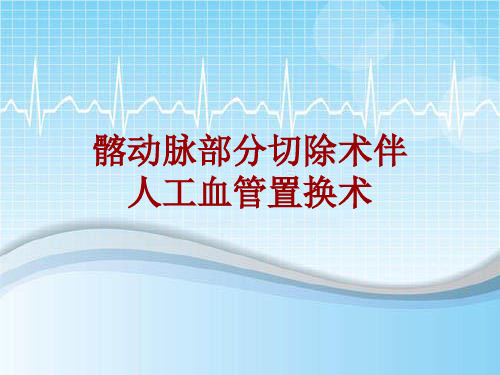 手术讲解模板：髂动脉部分切除术伴人工血管置换术