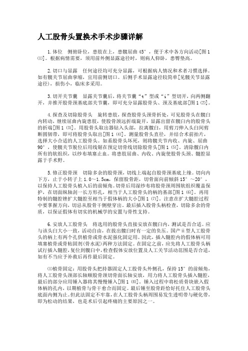 人工股骨头置换术手术步骤详解