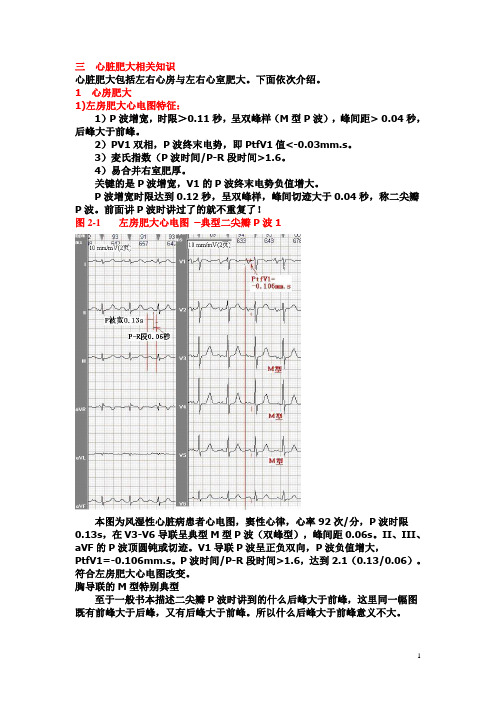 另类心电图讲义-11--心脏肥大