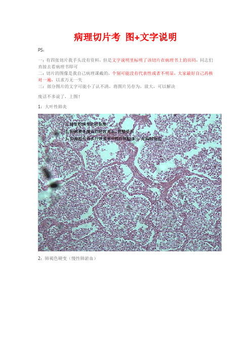 病理切片考 图+文字说明