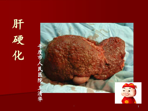 肝硬化完整PPT课件