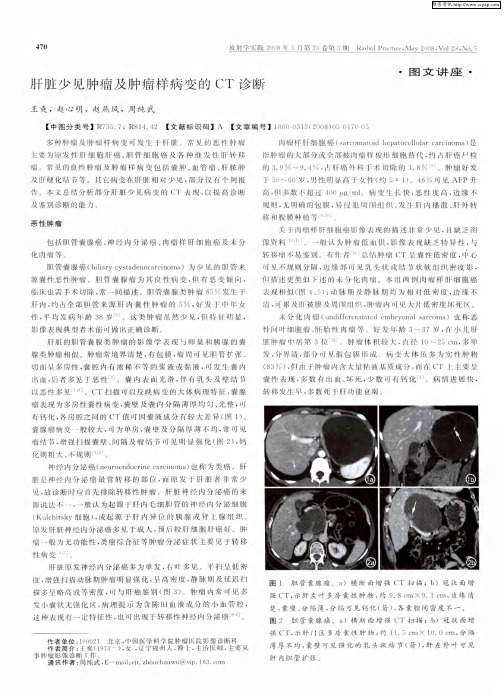 肝脏少见肿瘤及肿瘤样病变的CT诊断