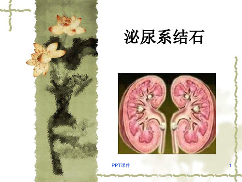 泌尿系结石  ppt课件