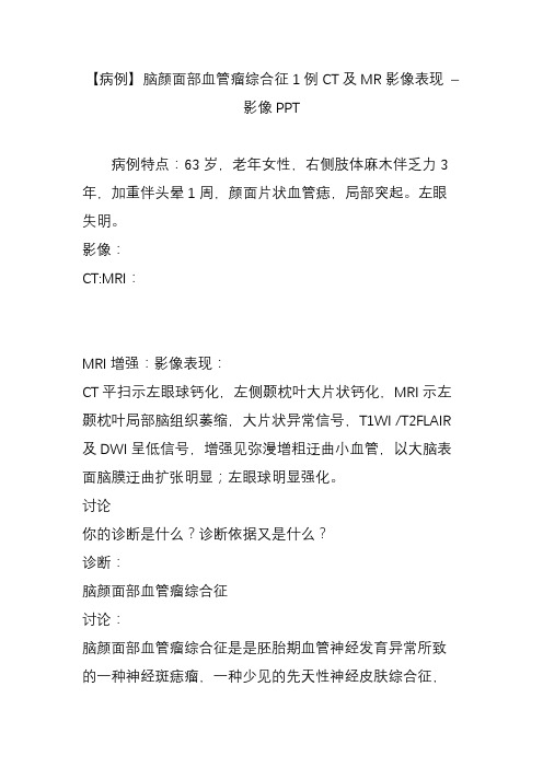 【病例】脑颜面部血管瘤综合征1例CT及MR影像表现 – 影像PPT