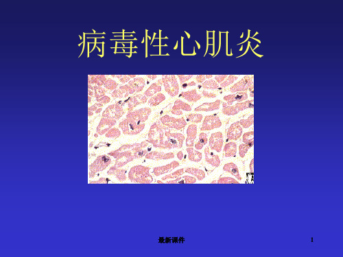 病毒性心肌炎的诊治专业课件PPT