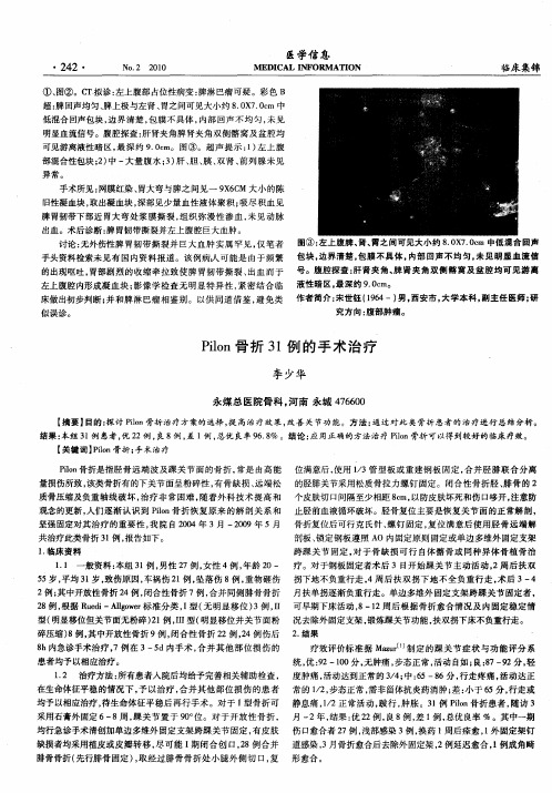 Pilon骨折31例的手术治疗