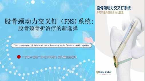 FNS：股骨颈骨折治疗的新选择