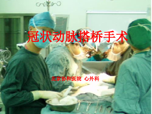 冠状动脉搭桥手术