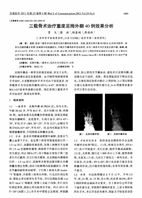 三截骨术治疗重度足拇外翻40例效果分析