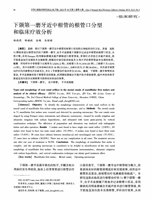 下颌第一磨牙近中根管的根管口分型和临床疗效分析