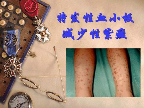特发性血小板减少性紫癜