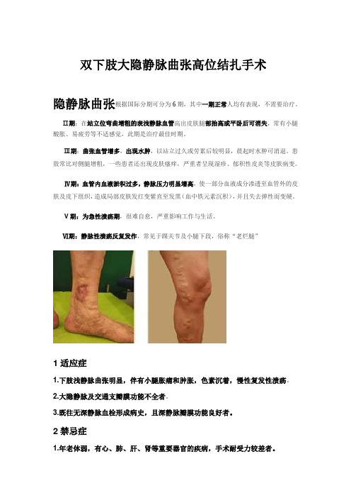 2、双下肢大隐静脉高位结扎手术