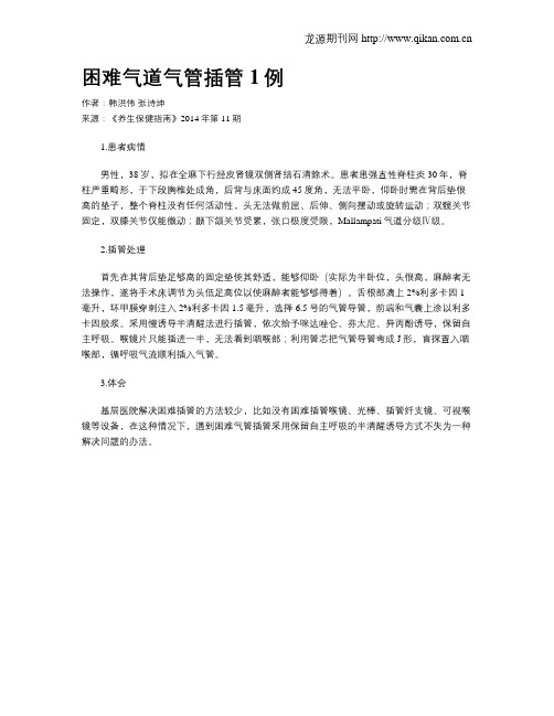困难气道气管插管1例
