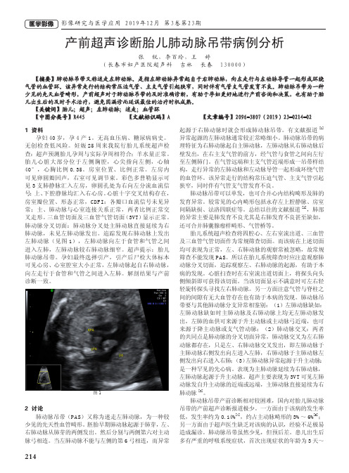 产前超声诊断胎儿肺动脉吊带病例分析