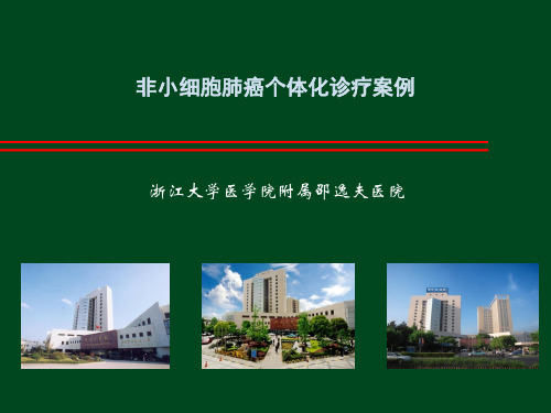 非小细胞肺癌个体化诊疗案例-邵逸夫