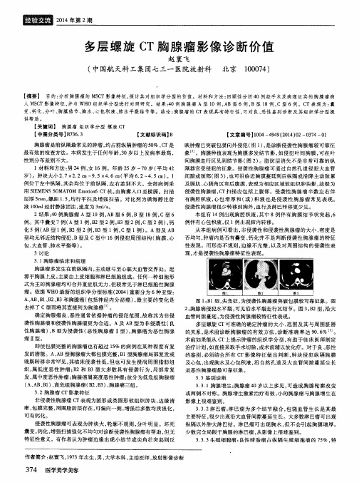 多层螺旋CT胸腺瘤影像诊断价值
