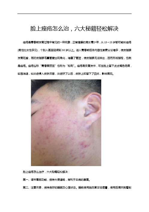 脸上痤疮怎么治,六大秘籍轻松解决