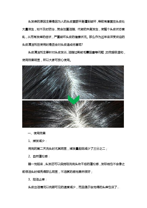 头皮清洁剂对头皮有害吗